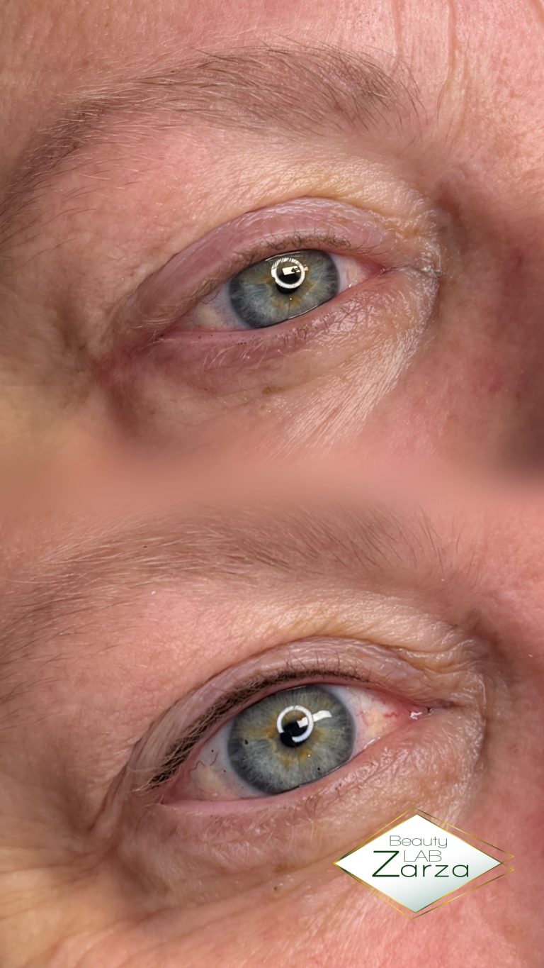 Voor en na: permanente eyeliner bij Beauty Lab Zarza