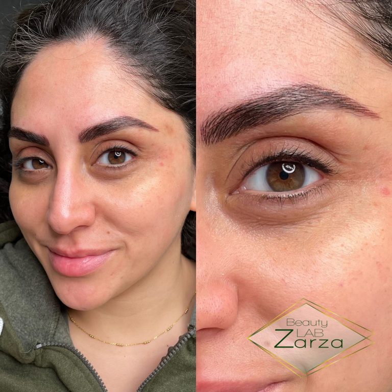 Voor en na: permanente eyeliner bij Beauty Lab Zarza